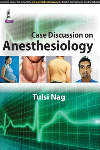 Case Discussion on Anesthesiology 1st/2015 (Reprint 2025)