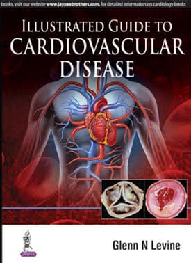 Illustrated Guide to Cardiovascular Disease 1st/2016