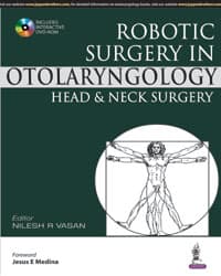 Robotic Surgery in Otolaryngology: Head and Neck Surgery 1st/2019