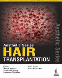 Aesthetic Series Hair Transplantation 1st/2016