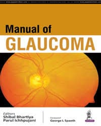 Manual of Glaucoma 1st/2016