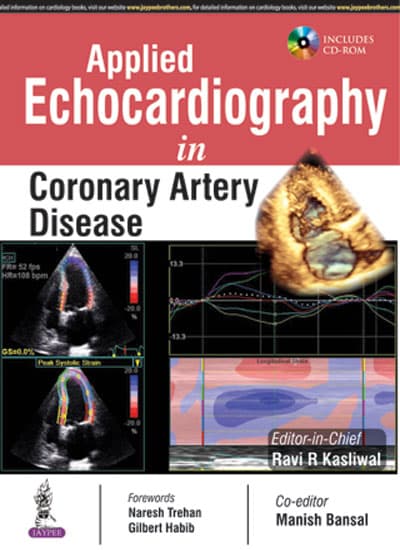 Applied Echocardiography in Coronary Artery Disease 1st/2016