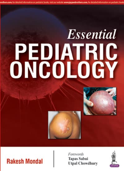 Essential Pediatric Oncology 1st/2016