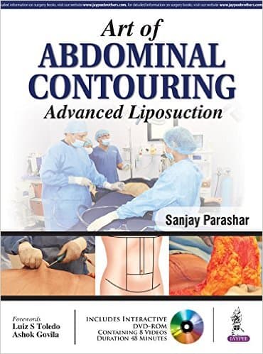 Art of Abdominal Contouring Advanced Liposuction 1st/2016