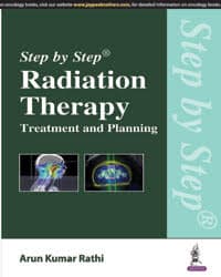 Step by Step Radiation Therapy Treatment and Planning 1st/2016