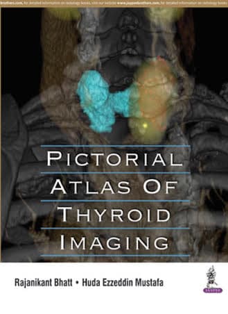 Pictorial Atlas of Thyroid 1st/2016