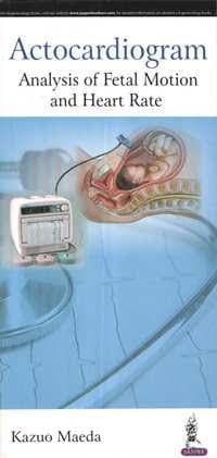 Actocardiogram Analysis of Fetal Motion and Heart Rate 1st/2016