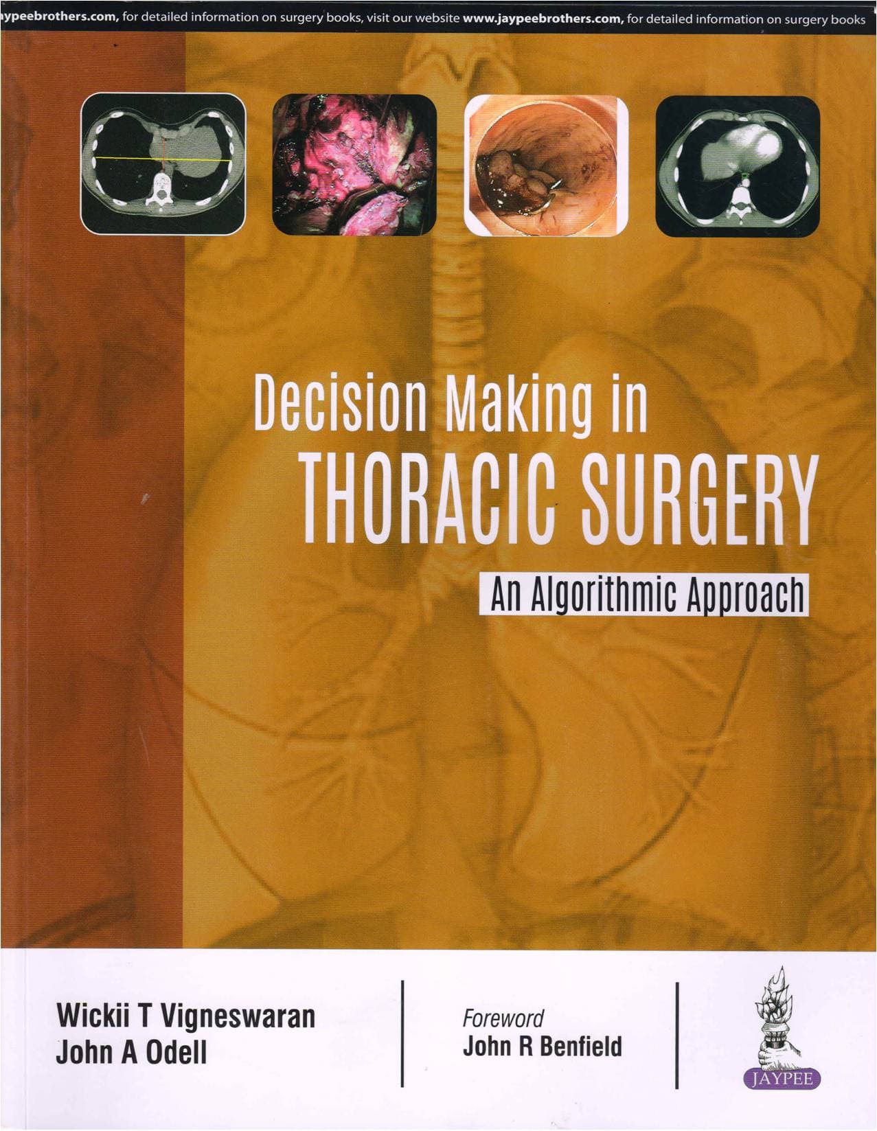 Decision Making in Thoracic Surgery 1st/2018
