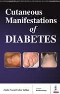 Cutaneous Manifestations of Diabetes 1st/2017