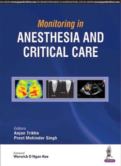 Monitoring in Anesthesia and Critical Care 1st/2018