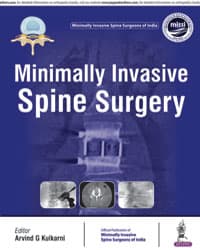 Minimally Invasive Spine Surgery 1st/2018