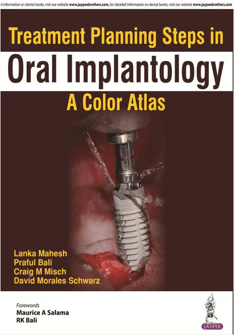 Treatment Planning Steps in Oral Implantology 1st/2018