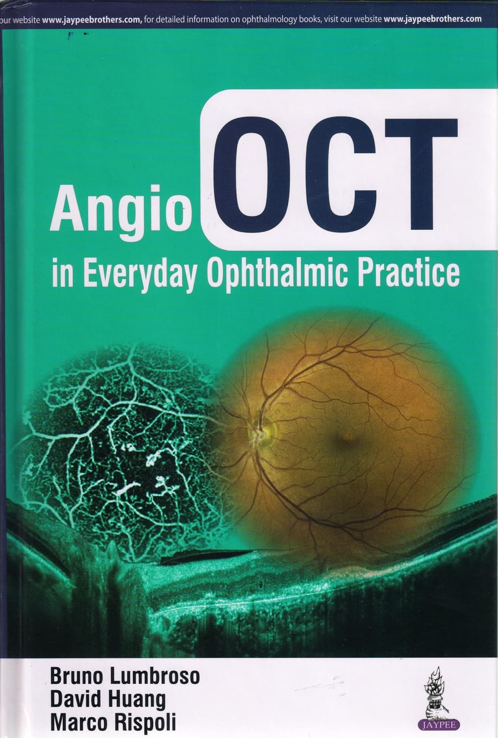 Angio OCT in Everyday Ophthalmic Practice 1st/2017
