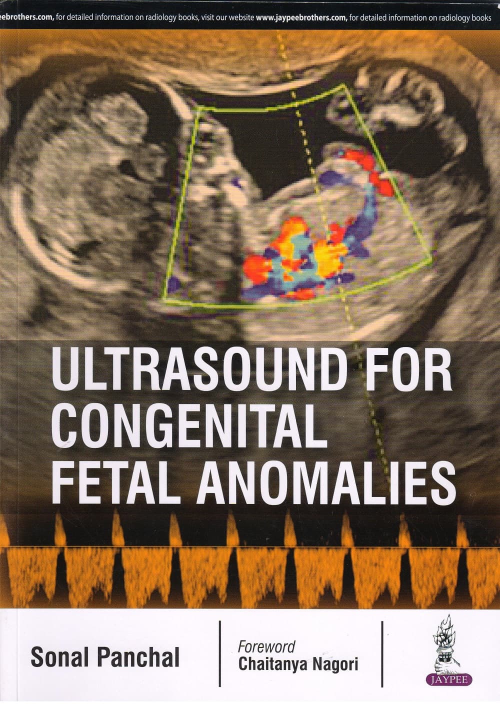 Ultrasound For Congenital Fetal Anomalies 1st/2017