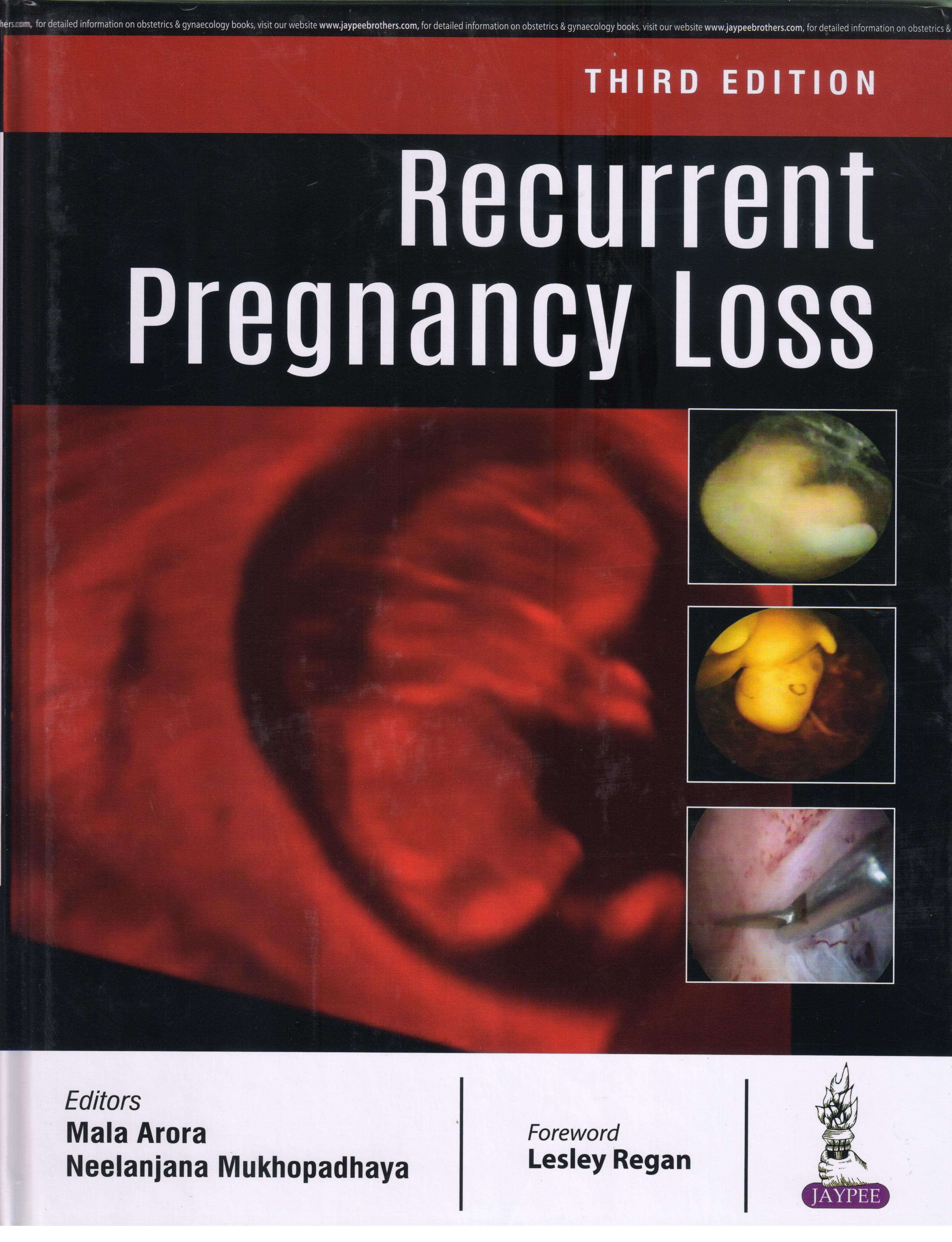 Recurrent Pregnancy Loss 3rd/2018
