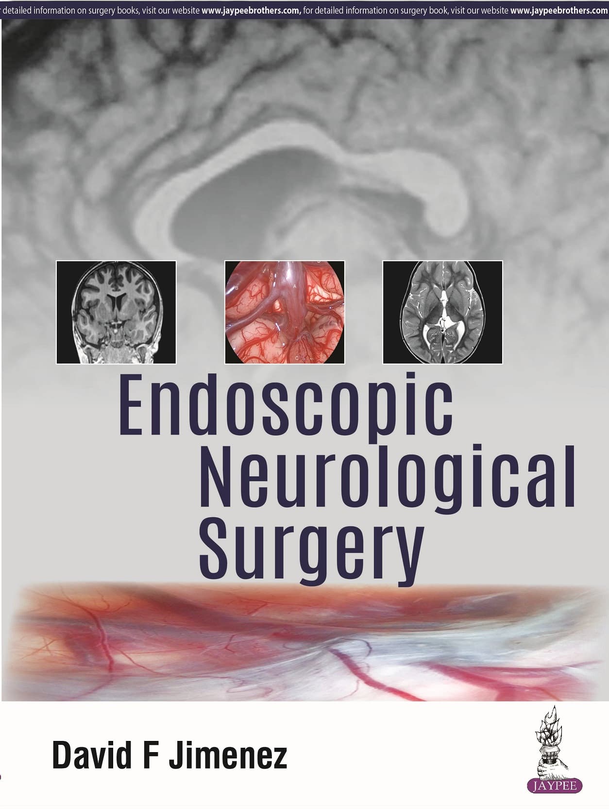 Endoscopic Neurological Surgery 1st/2018