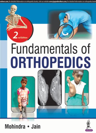 Fundamentals of Orthopedics 2nd/2018