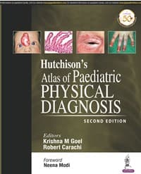 Hutchison’s Atlas of Pediatric Physical Diagnosis 2nd/2019