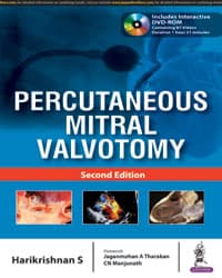 Percutaneous Mitral Valvotomy 2nd/2018