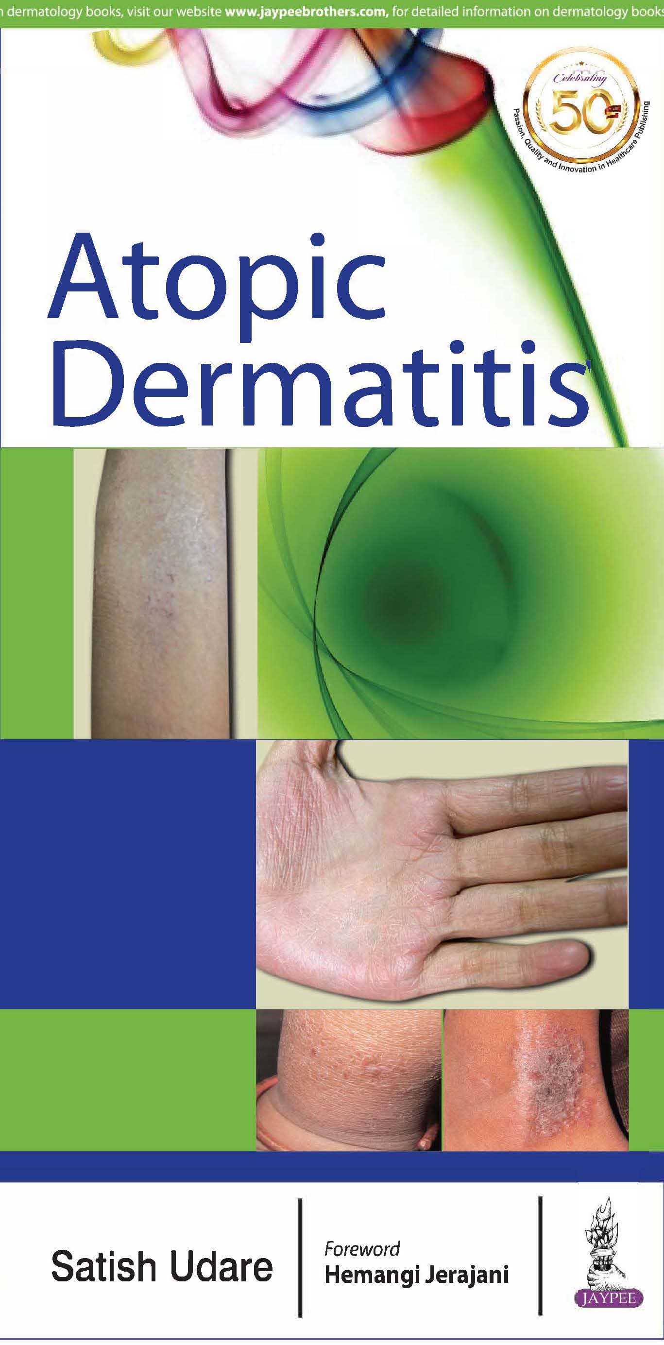 Atopic Dermatitis 1st/2018