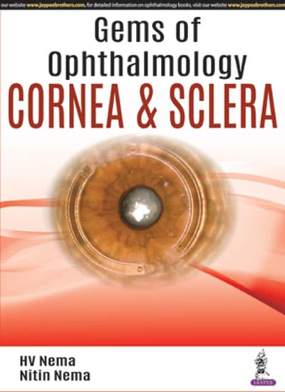 Gems of Ophthalmology Cornea and Sclera 1st/2018