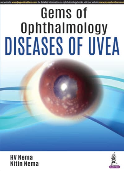 Gems of Ophthalmology Diseases of Uvea 1st/2018