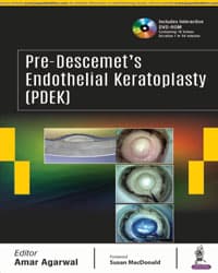 Pre-Descemet’s Endothelial Keratoplasty 1st/2018