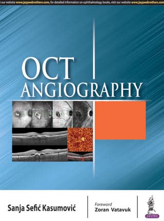 OCT Angiography 1st/2019