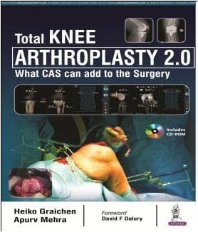 Total Knee Arthroplasty 2.0 1st/2018