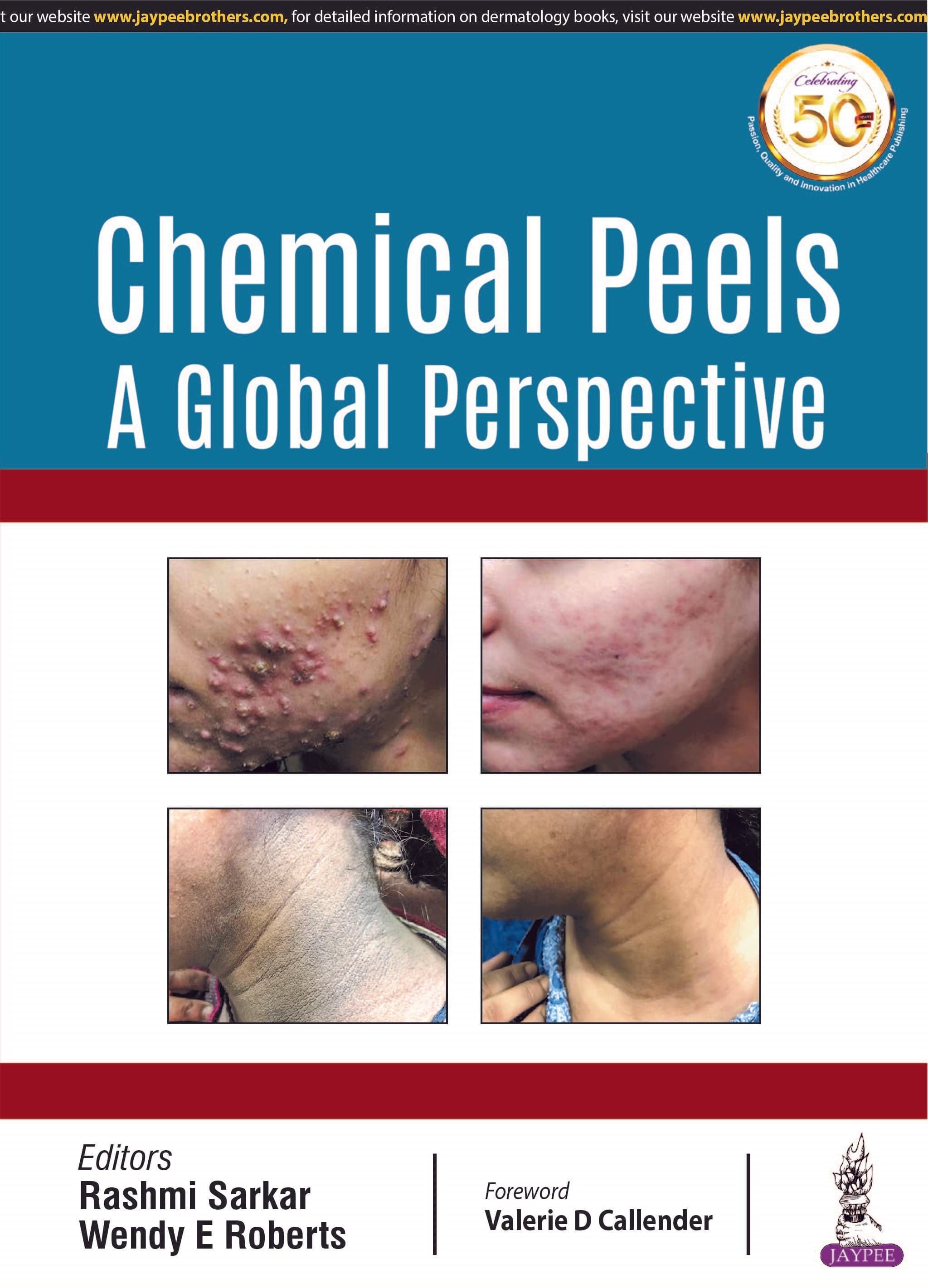 Chemical Peels 1st/2019 (Reprint 2025)
