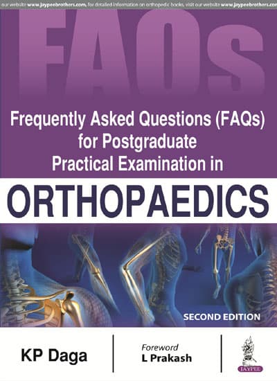 FAQs for Postgraduate Practical Examination in Orthopaedics 2nd/2018