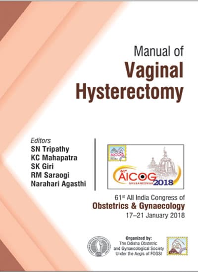 Manual of Vaginal Hysterectomy 1st/2018