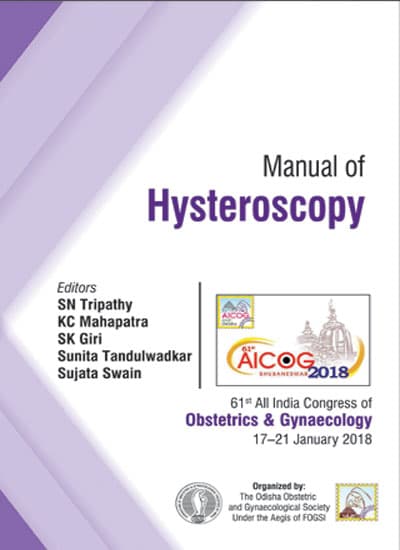 Manual of Hysteroscopy 1st/2018