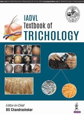 IADVL Textbook of Trichology 1st/2018