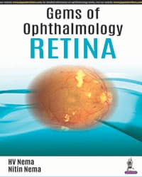 Gems of Ophthalmology Retina 1st/2018