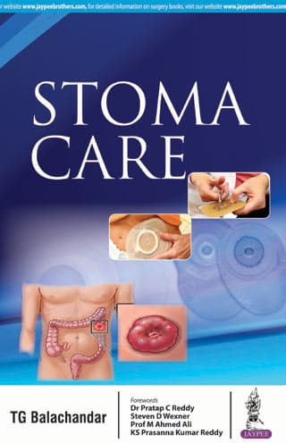 Stoma Care 1st/2018