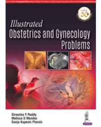 Illustrated Obstetrics and Gynecology Problems 1st/2020