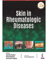 Skin in Rheumatologic Diseases 1st/2021