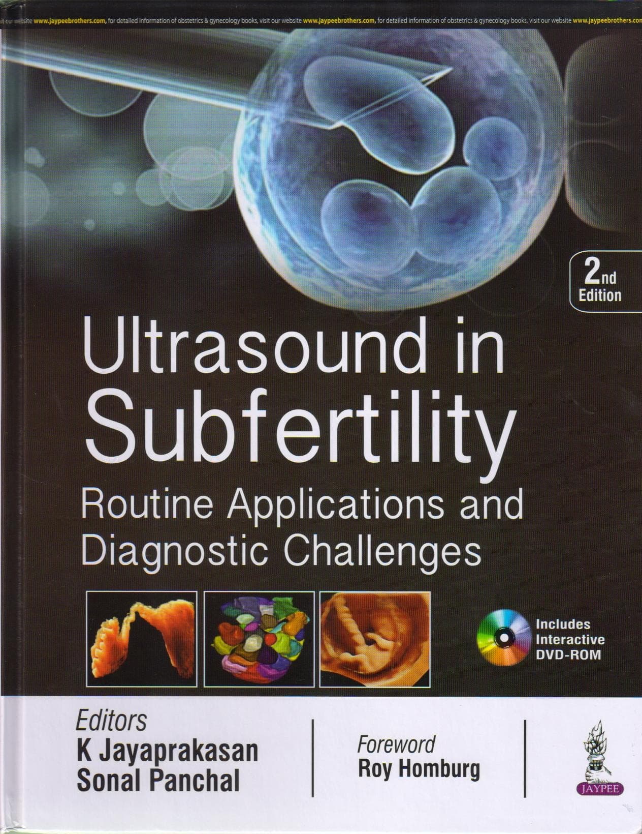 Ultrasound in Subfertility 2nd/2018
