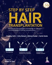 Step by Step Hair Transplantation 1st/2019