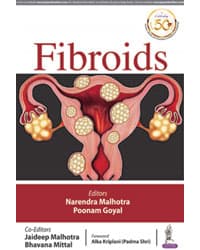 Fibroids 1st/2020