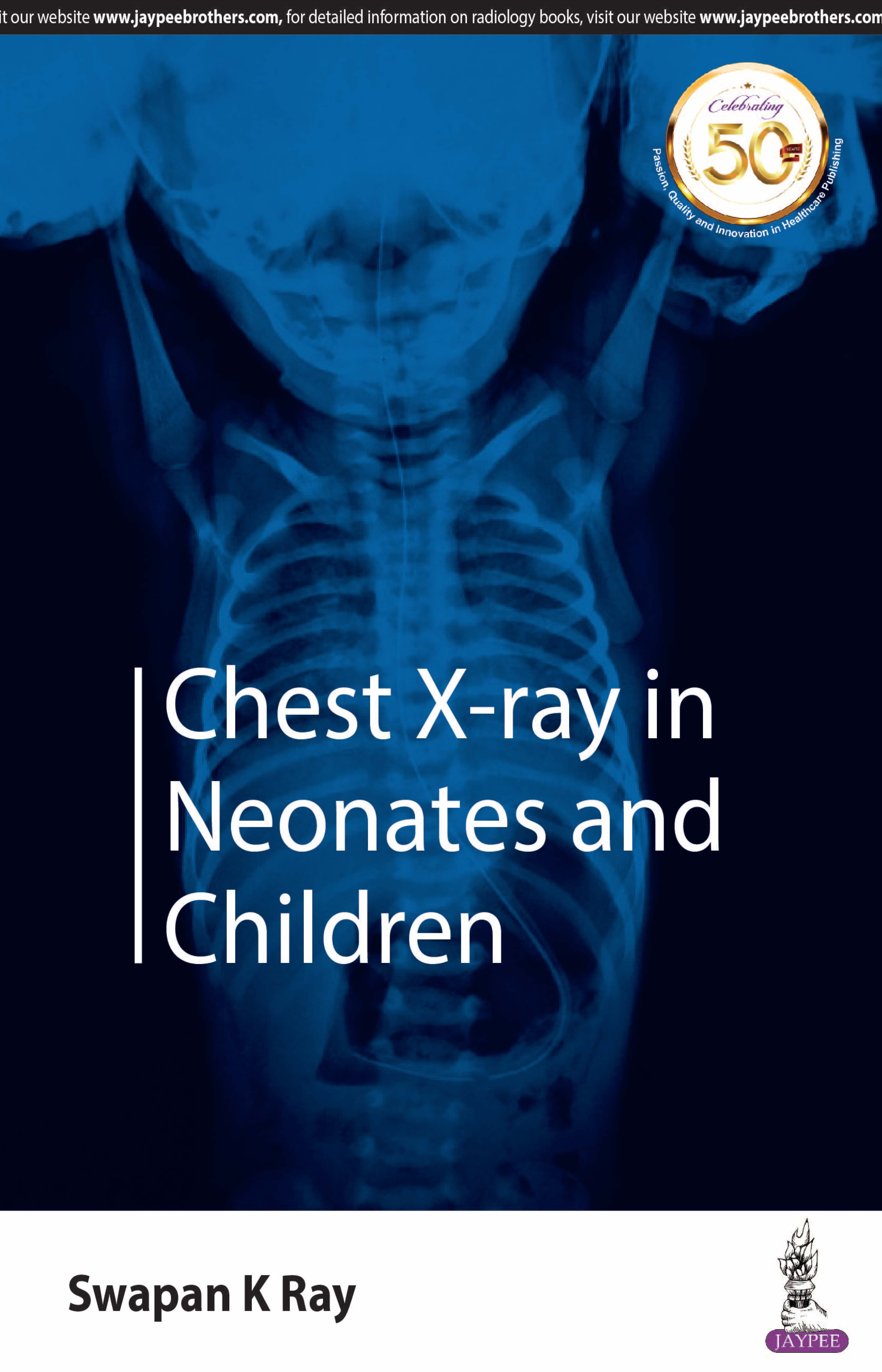 Chest X-ray in Neonates and Children 1st/2019