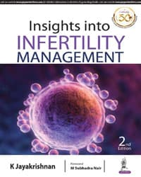 Insights Into Infertility Management 2nd/2019