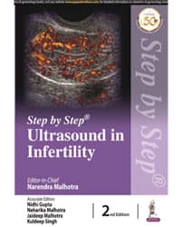 Step by Step Ultrasound in Infertility 2nd/2021