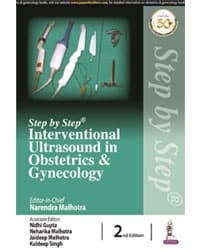Step by Step Interventional Ultrasound in Obstetrics & Gynecology 2nd/2021