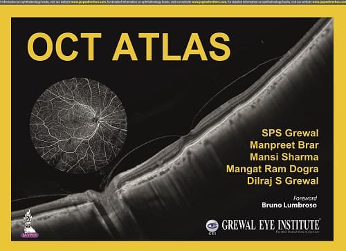 OCT Atlas 1st/2022