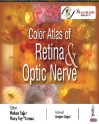 Color Atlas of Retina and Optic Nerve 1st/2022