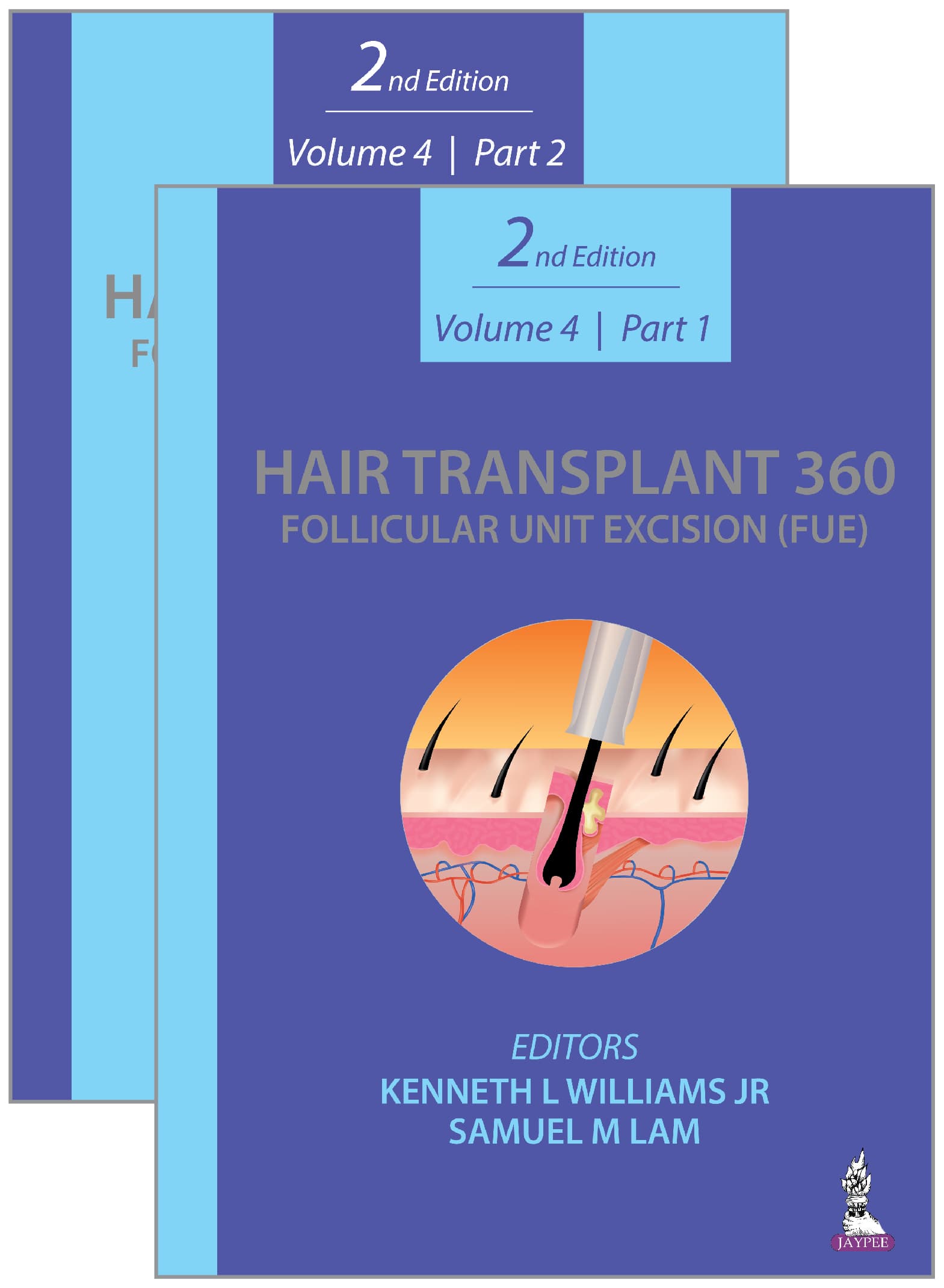 Hair Transplant 360: Follicular Unit Excision (FUE) 2nd/2022 (Vol 4 -  Part 1&2)