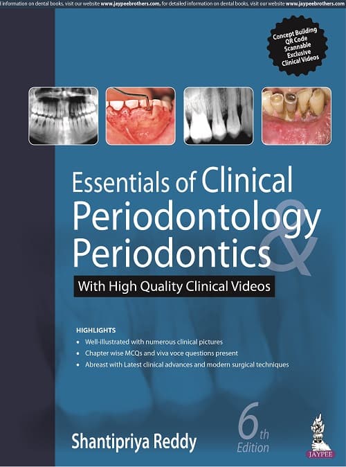 Essentials of Clinical Periodontology & Periodontics 6th/2022
