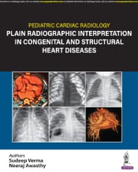 Pediatric Cardiac Radiology Plain Radiographic Interpretation in Congenital and Structural Heart Diseases 1st/2024